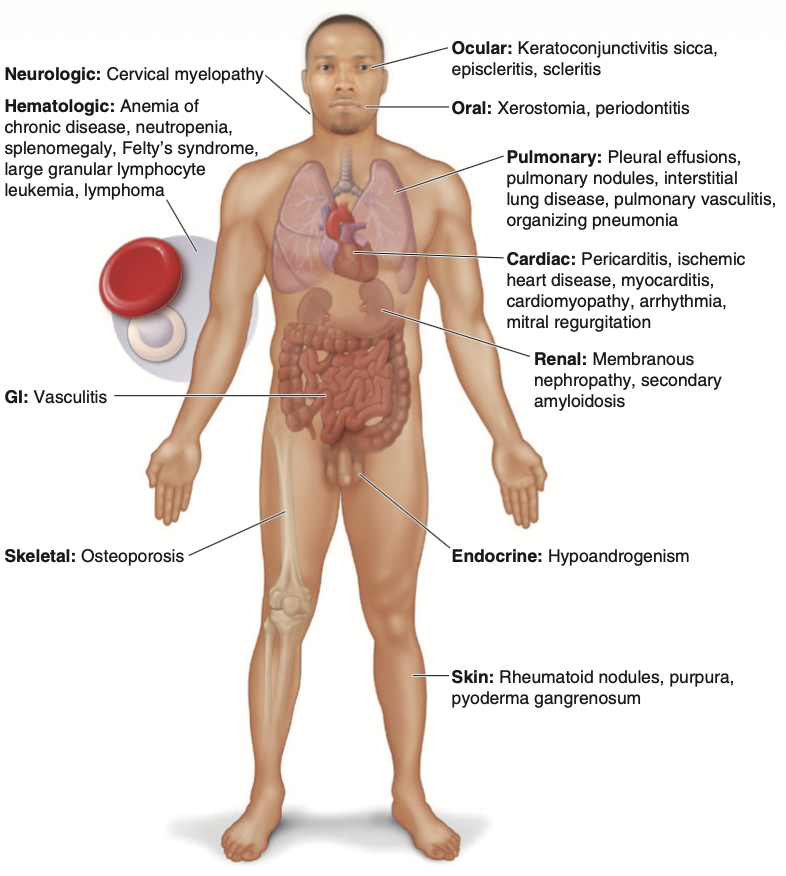 Pasted image 20260202132626.png|250