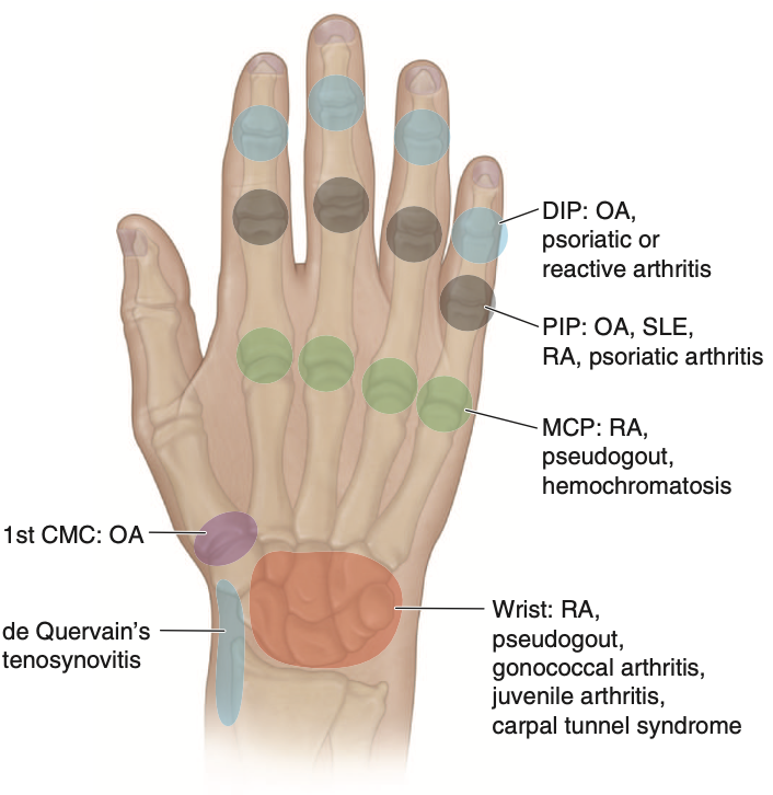 Pasted image 20260203183509.png|300